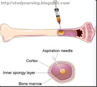Types of Biopsy